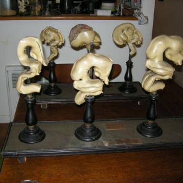 Very Rare Adolf Ziegler Embryo Stages of Development  Wax Models Circa 1900 on OriginalStands