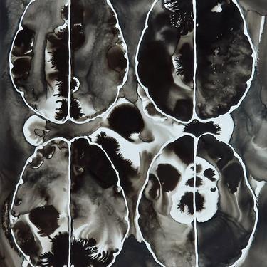 Black and White Brain Scan - Neuroscience Art 