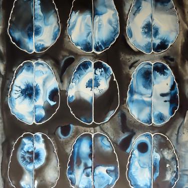 Brain Scan 18 -  original ink painting on yupo - Neuroscience Art 