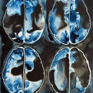 Brain Scan in Indigo and Black - Neuroscience Art 