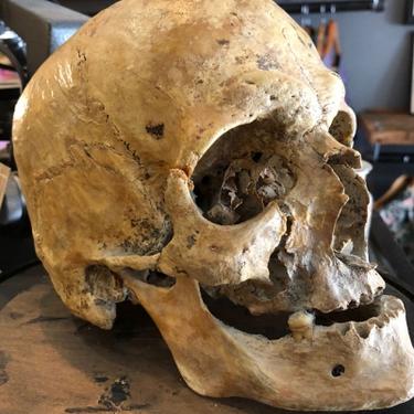 Antique Human Skull Masonic Display or Medical Skull Circa1900