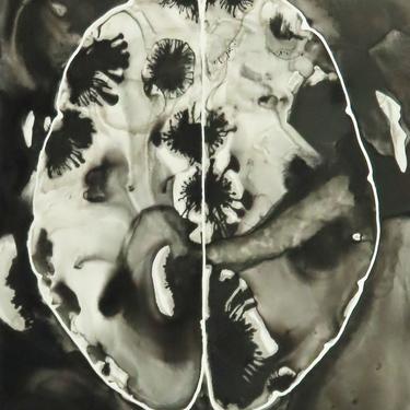 Areas of Concern Brain  -  original ink painting on yupo - neuroscience art 