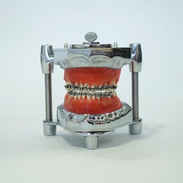 1930's Orthodontic Study Model
