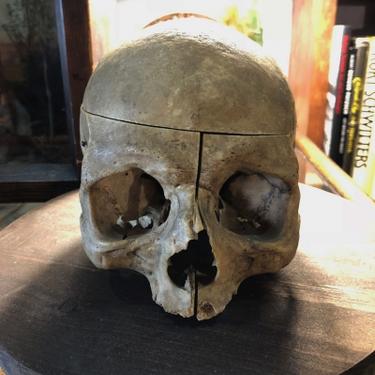 Circa 1907 Detnal Skull From Philadelphia School ofDentistry