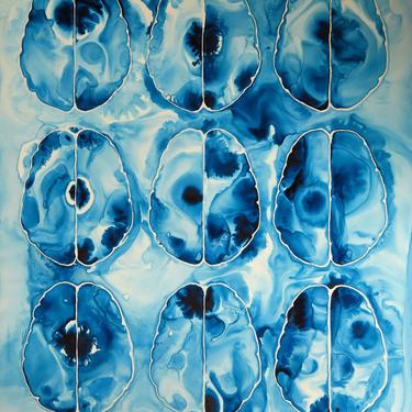 Brain Scan 17-  original ink painting on yupo - Neuroscience Art 